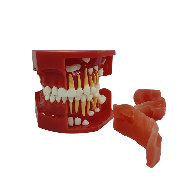 Fake Teeth, Teeth Mold, Teeth Model, Denture Model Brushing Practice Teeth  Mode Gingiva Visible Anatomic Demonstration Teaching Studying Standard Size